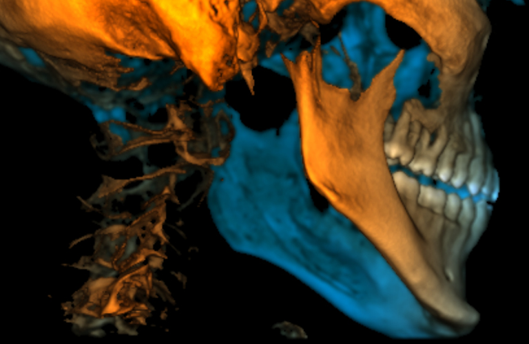 Planmeca Romexis Software Modules